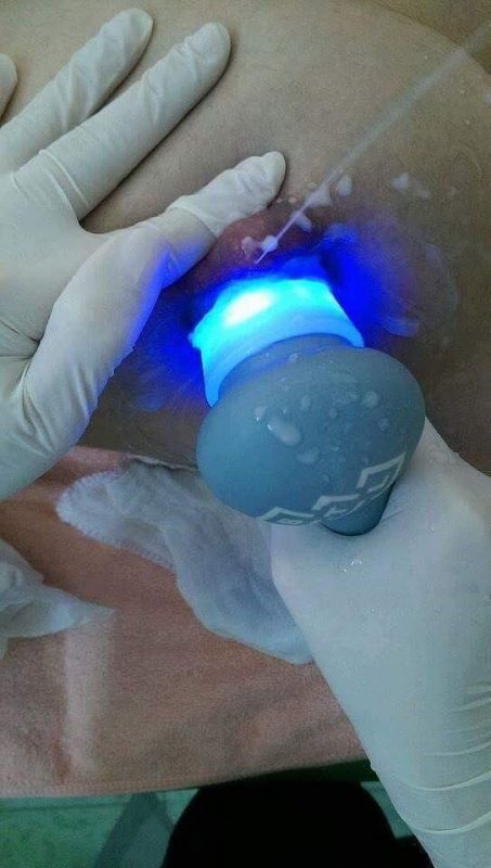Hưng Medela – Máy hút sữa mẹ
