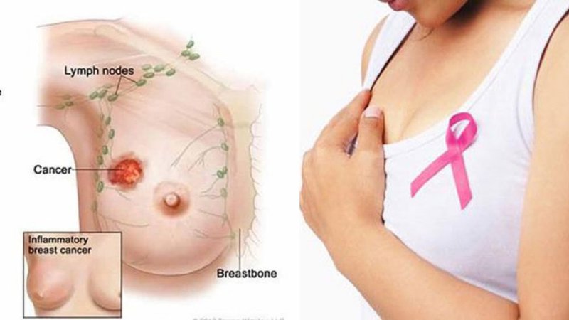 Hưng Medela – Máy hút sữa mẹ
