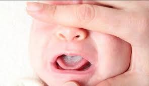 Hưng Medela – Máy hút sữa mẹ